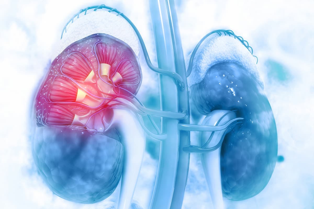 Pembrolizumab also demonstrated a disease-free survival benefit vs placebo for patients with clear-cell renal cell carcinoma. 